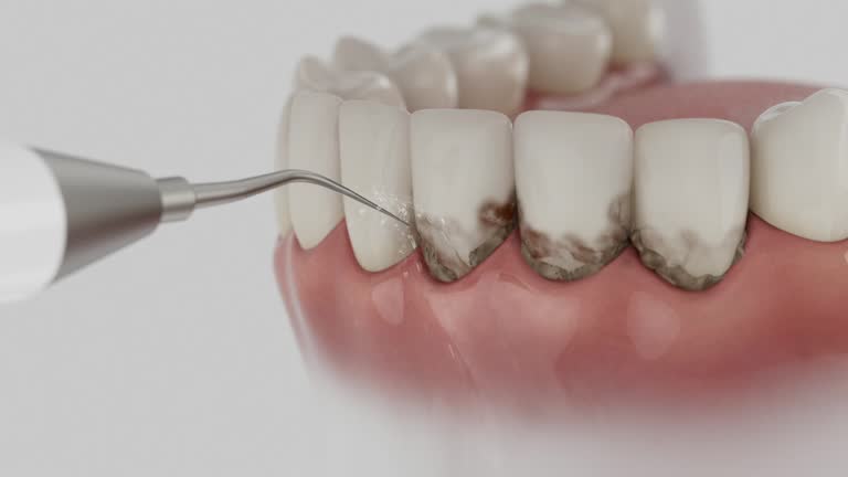 Reliable Tooth Extraction contractor in Bartow County County, GA by Dentist Open Now
